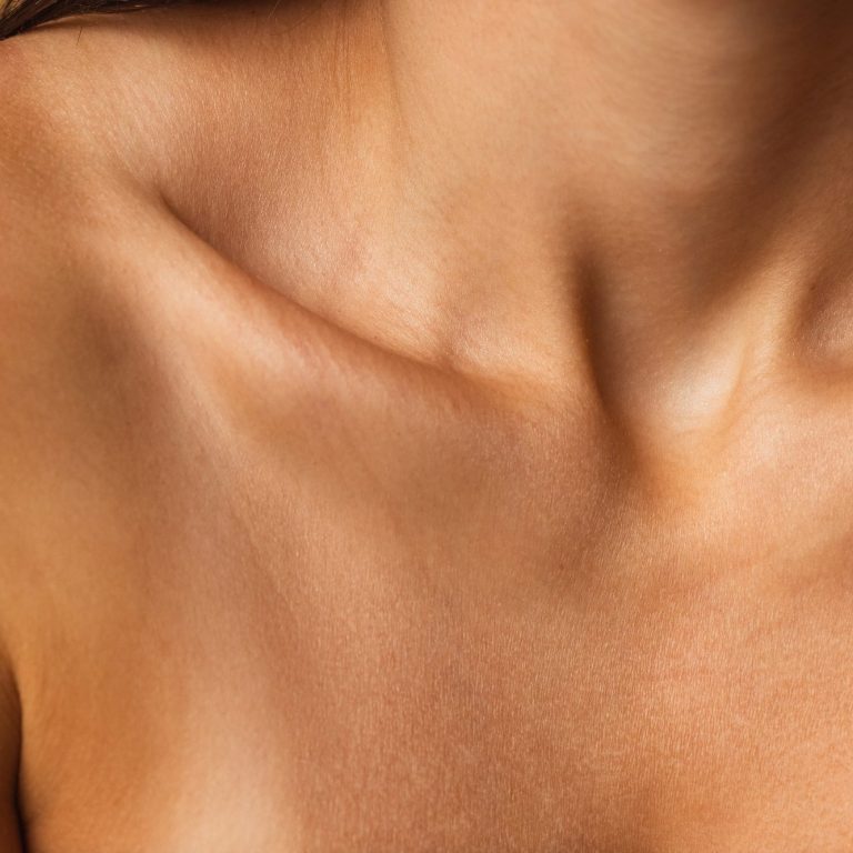 Medical Needling Behandlung bei SOVAL in Frankfurt 
